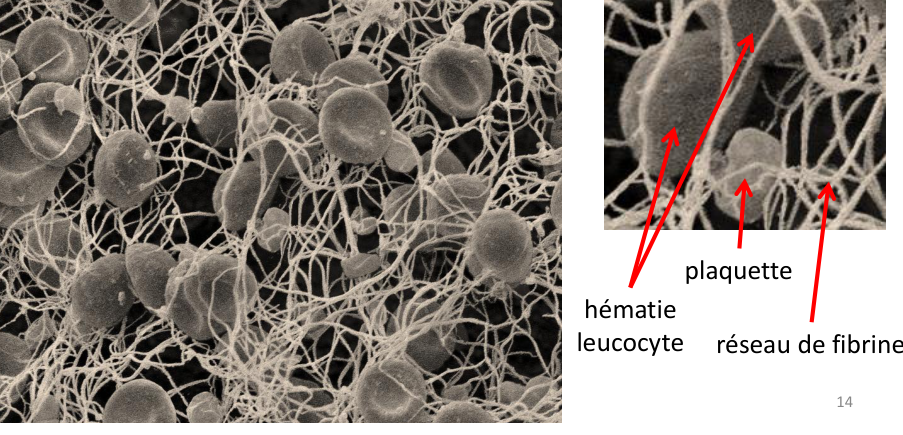 Le vrai filet : fibrine, plaquettes et globules rouges au microscope (support, p. 14).