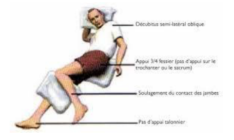 L’installation du support : un appui trois-quarts fessier qui soulage le sacrum et les talons.