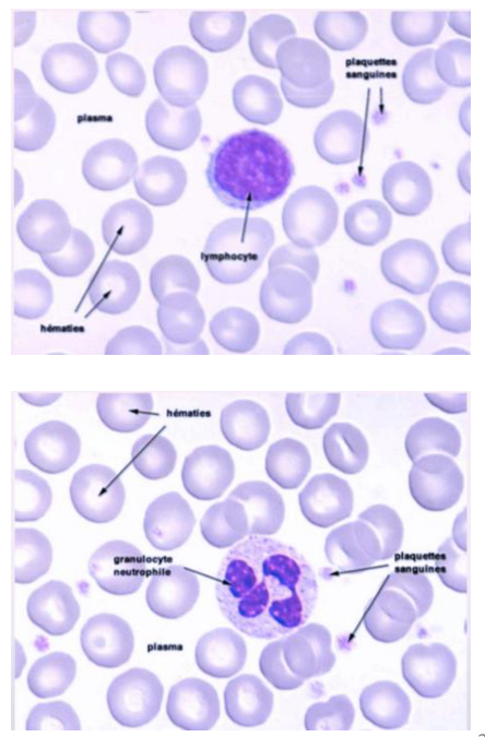 Frottis de sang au microscope : hématies, un lymphocyte, un granulocyte neutrophile, des plaquettes, le plasma